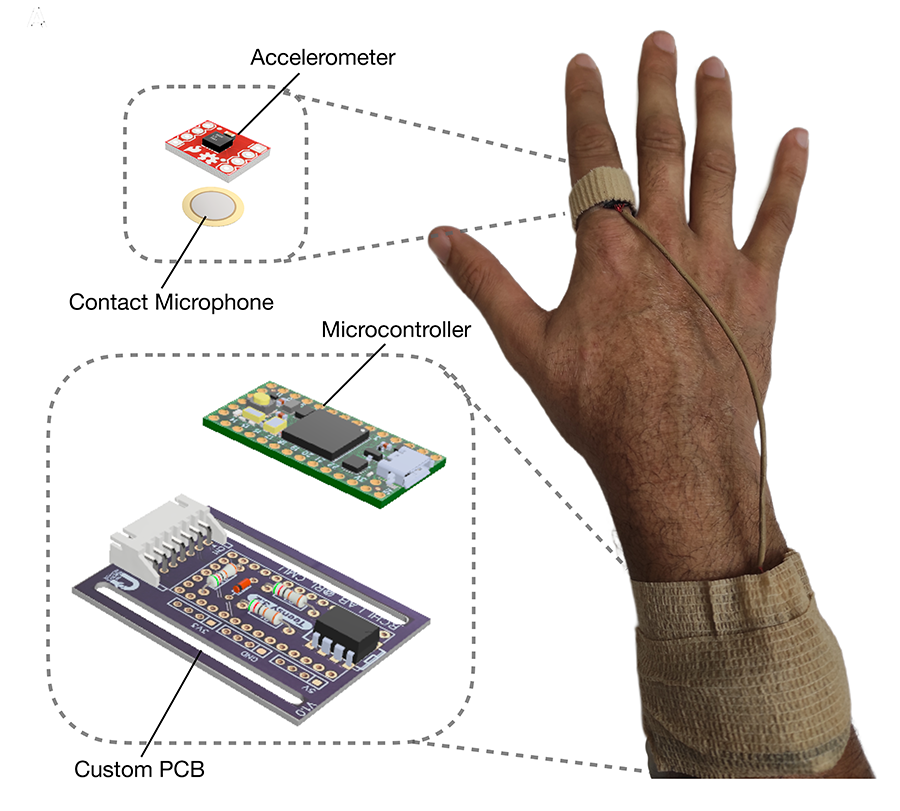  A schematic for the itch-detecting ring shows the ring on a human hand with zoomed in sections that highlight the ring's components: an accelerometer and contact microphone, a microcontroller, and the custom PCB.